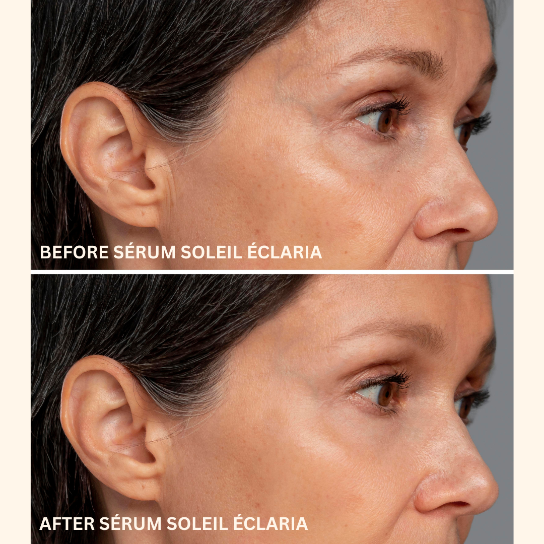 Before and after comparison of a woman's face with Sérum Soleil Eclaria treatment.
